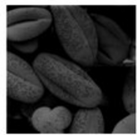 Computation on Stochastic Bit Streams: Digital Image Processing Case Studies